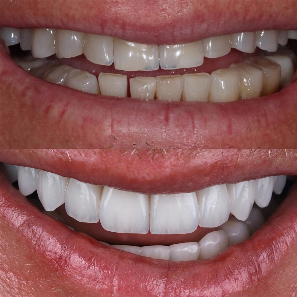 Protocolos dentários